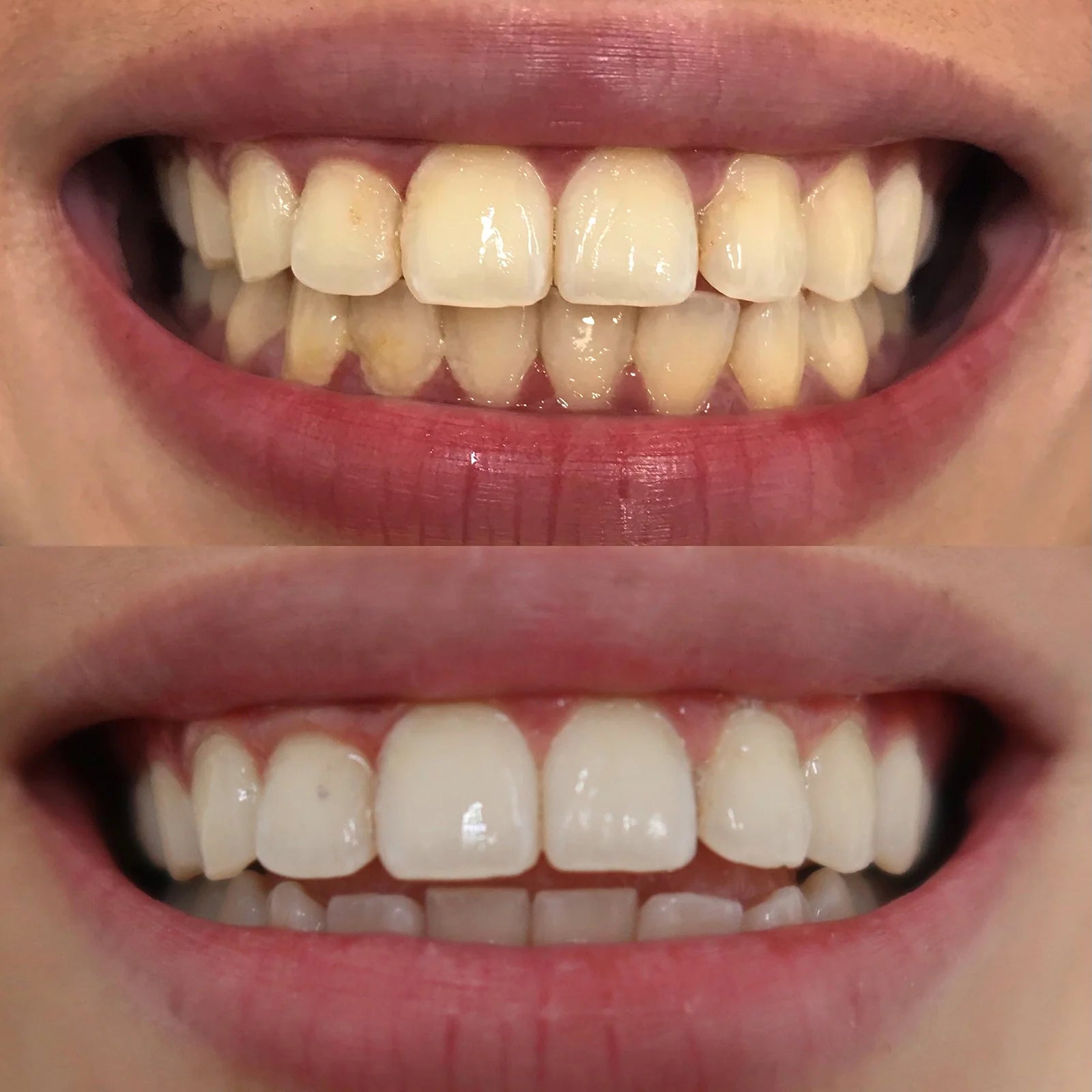 Before and after