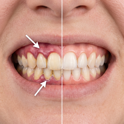 VeroBase Collagen Gum Powder